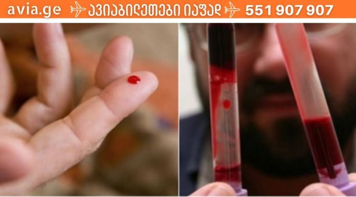 სისხლის სისქის – სიმბლანტის შესამცირებელი მეთოდები.