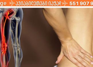 6 მარტივი გზა საჯდომის ნერვის (რადიკულიტის) ტკივილისგან თავის დასაღწევად