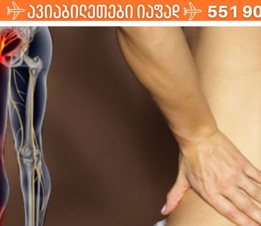 6 მარტივი გზა საჯდომის ნერვის (რადიკულიტის) ტკივილისგან თავის დასაღწევად