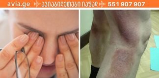 დიაბეტის საშინელი სიმპტომები,რომლებიც არ უნდა გამოგეპაროთ
