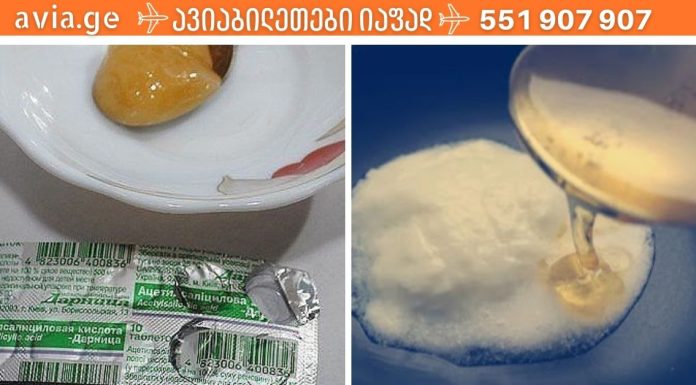 გაინტერესებთ როგორ გიხსნით თაფლიანი ასპირინი მუხლების ტკივილისგან? მაშინ უნდა ცადოთ ეს რეცეპტი.