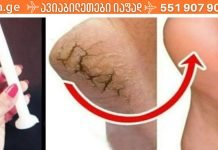 როგორ მოვიშოროთ დაბზარული ქუსლები