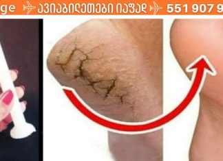 როგორ მოვიშოროთ დაბზარული ქუსლები