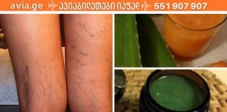 ეს ძველი ხალხური რეცეპტი შეამცირებს ვარიკოზული ვენების სიმპტომებს