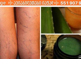 ეს ძველი ხალხური რეცეპტი შეამცირებს ვარიკოზული ვენების სიმპტომებს