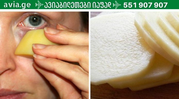 უმი კარტოფილის სარგებელი სახის კანისთვის,იდეალურია.