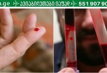 სქელი სისხლი: როგორ აღვადგინოთ სისხლის ხარისხი,სისხლის შედედების პროვოცირება ,ეს ყველაფერი უნდა იცოდეთ,რომ სწორად მართოთ თქვენი მდგომარეობა.