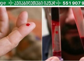 სქელი სისხლი: როგორ აღვადგინოთ სისხლის ხარისხი,სისხლის შედედების პროვოცირება ,ეს ყველაფერი უნდა იცოდეთ,რომ სწორად მართოთ თქვენი მდგომარეობა.