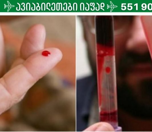 სქელი სისხლი: როგორ აღვადგინოთ სისხლის ხარისხი,სისხლის შედედების პროვოცირება ,ეს ყველაფერი უნდა იცოდეთ,რომ სწორად მართოთ თქვენი მდგომარეობა.