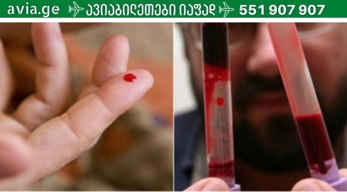 სქელი სისხლი: როგორ აღვადგინოთ სისხლის ხარისხი,სისხლის შედედების პროვოცირება ,ეს ყველაფერი უნდა იცოდეთ,რომ სწორად მართოთ თქვენი მდგომარეობა.