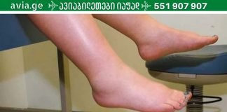 როგორ მოვიშოროთ ფეხების შეშუპება: 11 მარტივი რჩევა