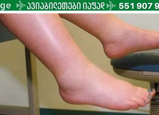 როგორ მოვიშოროთ ფეხების შეშუპება: 11 მარტივი რჩევა