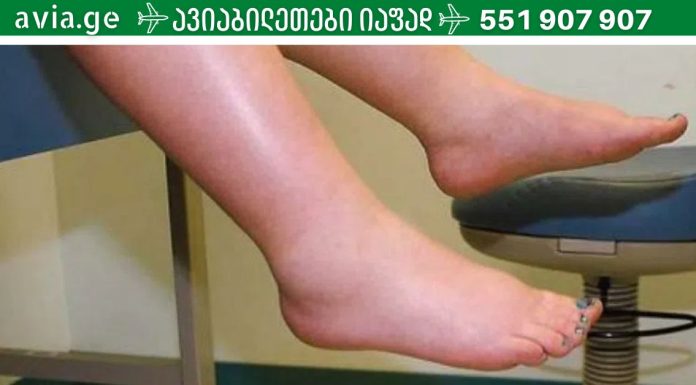 როგორ მოვიშოროთ ფეხების შეშუპება: 11 მარტივი რჩევა