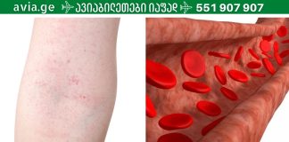 რა უნდა გავაკეთოთ სისხლძარღვებს ელასტიურიბა და სიჯანსაღე რომ დავუბრუნოთ?