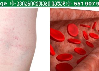 რა უნდა გავაკეთოთ სისხლძარღვებს ელასტიურიბა და სიჯანსაღე რომ დავუბრუნოთ?