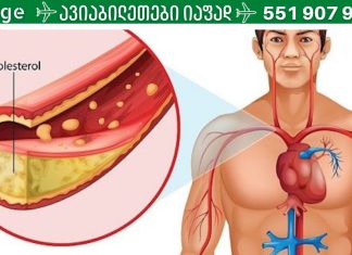 ქოლესტერინი რომელსაც უნდა უფრთხილდეთ.