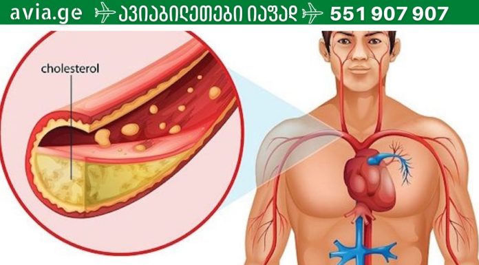 ქოლესტერინი რომელსაც უნდა უფრთხილდეთ.