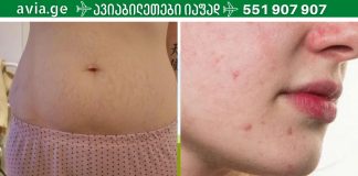 ნაწიბურების და სტრიებისთვის ეს საშუალება შეუდარებელია