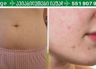 ნაწიბურების და სტრიებისთვის ეს საშუალება შეუდარებელია