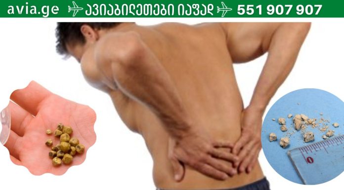 ეს უნდა იცოდეთ.წელის ტკივილი ,თირკმელში კენჭის არსებობის სიმპტომი შეიძლება იყოს