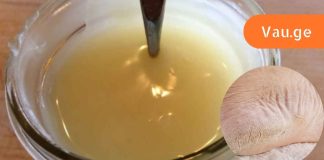 ჩემმა დამ მასწავლა დაბზარული ქუსლების მკურნალობა სახლის პირობებში,ვერცერთ სააფთიაქო საშუალებამ ვერ მიშველა.