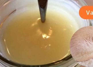 ჩემმა დამ მასწავლა დაბზარული ქუსლების მკურნალობა სახლის პირობებში,ვერცერთ სააფთიაქო საშუალებამ ვერ მიშველა.