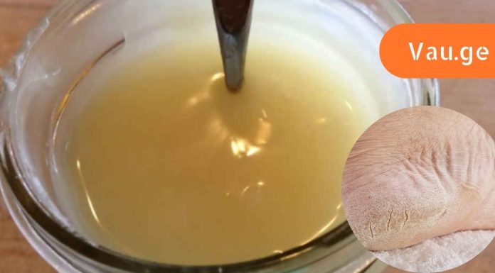 ჩემმა დამ მასწავლა დაბზარული ქუსლების მკურნალობა სახლის პირობებში,ვერცერთ სააფთიაქო საშუალებამ ვერ მიშველა.