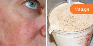 ამ ქალბატონმა გამოიყენა რძე და ზაფრანა სახეზე და ამის შესახებ ყველას უზიარებს მის სასწაულ შედეგებს