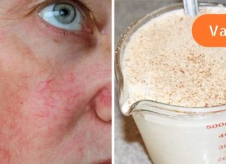 ამ ქალბატონმა გამოიყენა რძე და ზაფრანა სახეზე და ამის შესახებ ყველას უზიარებს მის სასწაულ შედეგებს