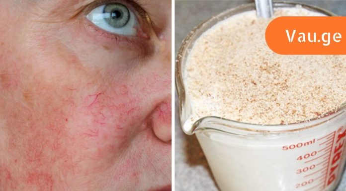 ამ ქალბატონმა გამოიყენა რძე და ზაფრანა სახეზე და ამის შესახებ ყველას უზიარებს მის სასწაულ შედეგებს