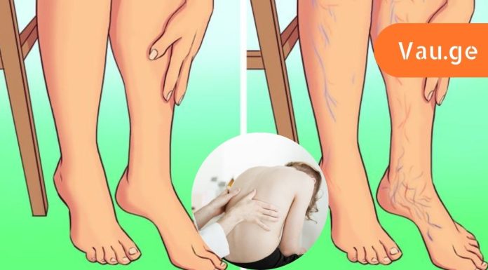 რატო არ უნდა იაროთ ფეხშიშველმა სახლში ,რა რისკის ქვეშ ხაერთ ამ დროს.