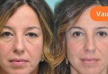 ყველაზე ცუდი ყოველდღიური ჩვევები, რომლებიც ჭამს შენს ახალგაზრდობას.