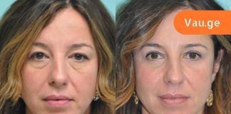 ყველაზე ცუდი ყოველდღიური ჩვევები, რომლებიც ჭამს შენს ახალგაზრდობას.