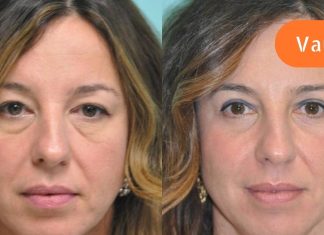 ყველაზე ცუდი ყოველდღიური ჩვევები, რომლებიც ჭამს შენს ახალგაზრდობას.