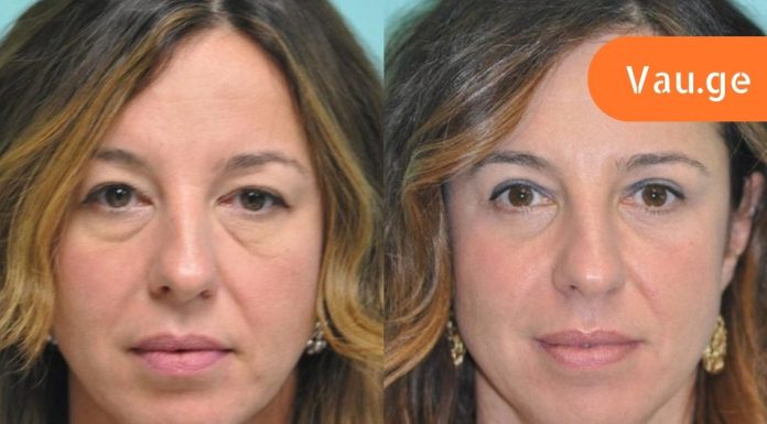 ყველაზე ცუდი ყოველდღიური ჩვევები, რომლებიც ჭამს შენს ახალგაზრდობას.