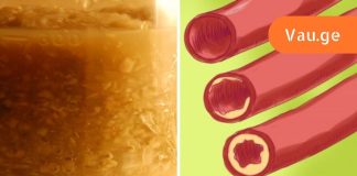 სისხლძარღვებს ამაზე უკეთესად ვერცერთი მედიკამენტით გაიწმინდავთ,ნახეთ კურკუმას და ძმრის საოცარი თვისებების შესახებ