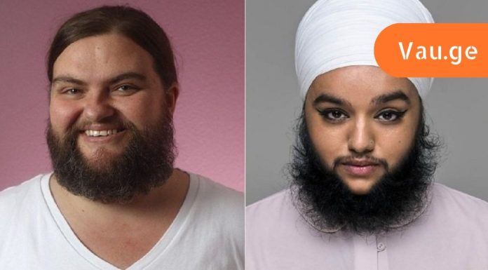 დიახ ამ ქალბატონებმა დაარღვიეს სტერეოტიპები.სახეზე თმა ქალების დიდი პრობლემაა,როგორ უნდა მოაგვაროთ და როგორ უნდა შეიყვაროთ საკუთარი თავი როგორიც ხართ