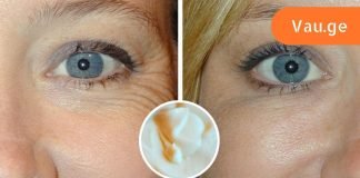 ამას სხვაგან ვერ წაიკითხავ,ნაოჭების საწინააღმდეგო საცხი შენც შეგიძლია გააკეთო სახლში