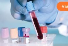 არის თუ არა პირველი სისხლის ჯგუფი ყველაზე ცუდი?რა დაავადებების საფრთხის წინაშე ვდგავართ ოთხივე ჯგუფის ადამიანები?