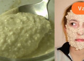 ერთი თვის შემდეგ მან გააცნობიერა, რომ მრავალი წლით ახალგაზრდად გამოიყურებოდა! სახის დამუშავება კვირაში 2-ჯერ.