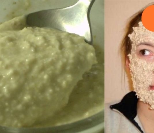 ერთი თვის შემდეგ მან გააცნობიერა, რომ მრავალი წლით ახალგაზრდად გამოიყურებოდა! სახის დამუშავება კვირაში 2-ჯერ.