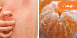 რატომ არის ზომიერება მნიშვნელოვანი მანდარინის ჭამის დროს? ყურადღება მიაციეთ დაავადებების ჩამონათვალს