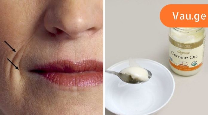 48 წლის ასაკში მან ადვილად მოიშორა ნაოჭები!”მოვიშორე ძვირადფასიანი კრემები”.ნახეთ ვრცლად.