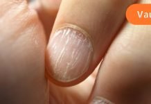 ეს ნიშნები მიგანიშნებთ რომ ორგანიზმს ცილა აკლია,იხილეთ ვრცლად…