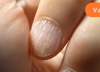 ეს ნიშნები მიგანიშნებთ რომ ორგანიზმს ცილა აკლია,იხილეთ ვრცლად…