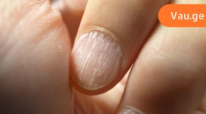 ეს ნიშნები მიგანიშნებთ რომ ორგანიზმს ცილა აკლია,იხილეთ ვრცლად…