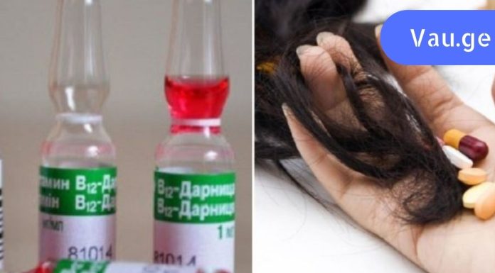 თმის ცვენის შეჩერება შესაძლებელია? სააფთიაქო ვიტამინები თმის ცვენის საწინააღმდეგოდ!თმის ზრდის სტიმულირება