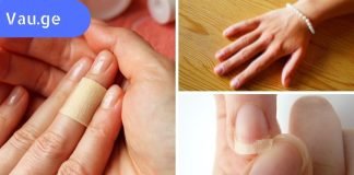 9 საშიში დაავადება,რომელსაც მიხვდებით თქვენს ხელებზე დაკვირვებით.