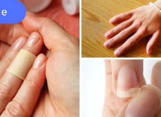 9 საშიში დაავადება,რომელსაც მიხვდებით თქვენს ხელებზე დაკვირვებით.
