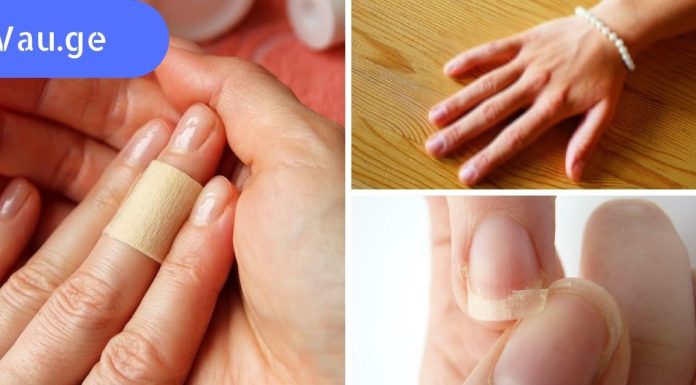 9 საშიში დაავადება,რომელსაც მიხვდებით თქვენს ხელებზე დაკვირვებით.